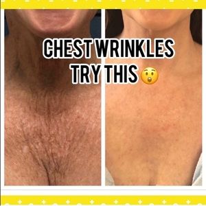 Chest wrinkle try this